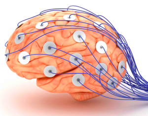 Neurología